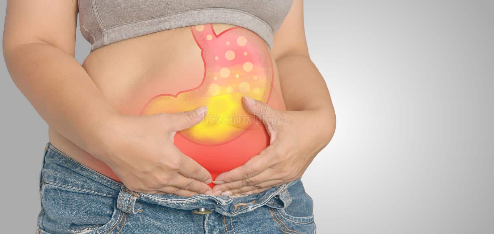 Acid reflux GERD
